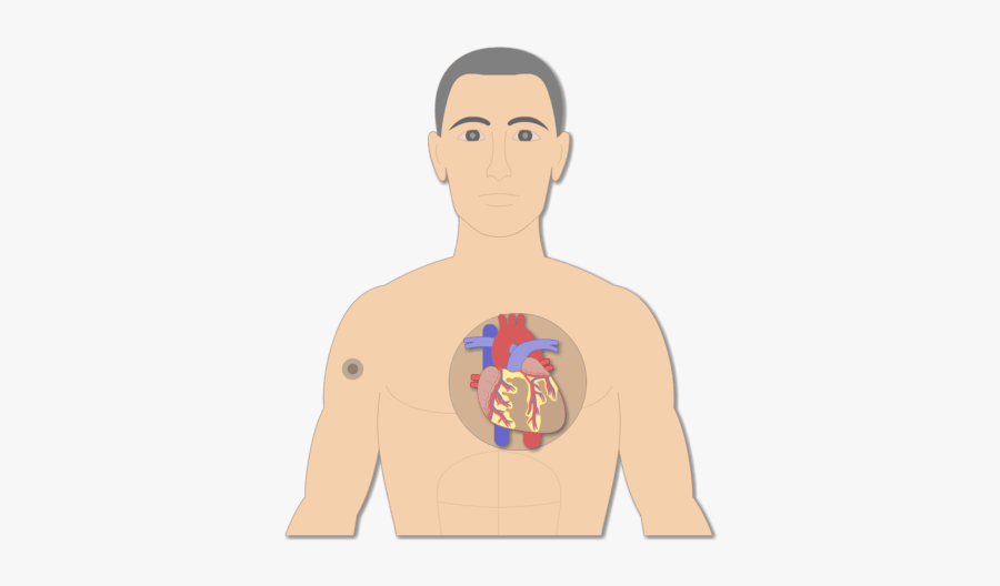 Placement Of The Bipolar Lead Electrodes Animation - Einthoven Triangle On Chest, Transparent Clipart