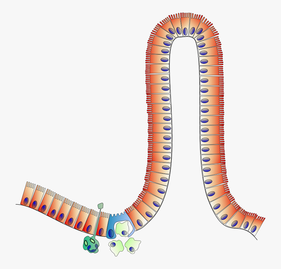 Peyer Patch - Peyer's Patches Clipart, Transparent Clipart