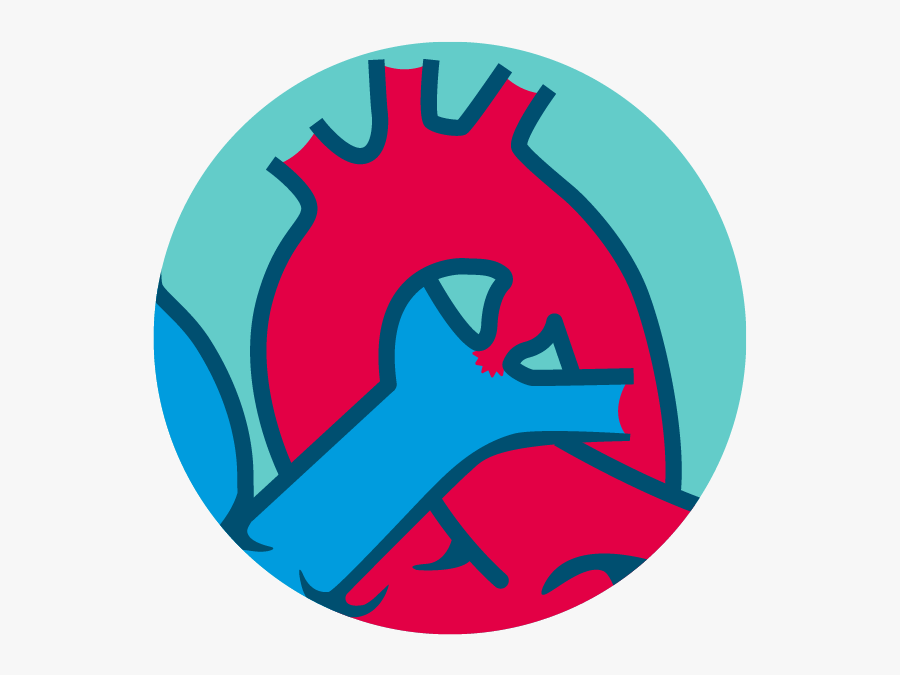 Type A - Conical - Atrial Septal Defect Png, Transparent Clipart