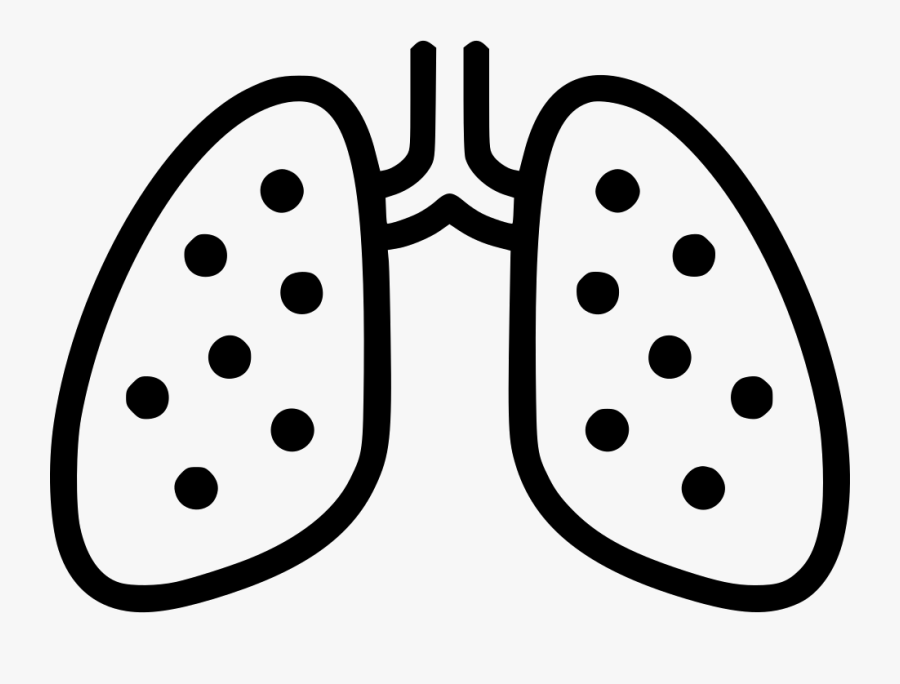Lungs Chest X Ray Anatomy Tuberculosis Pneumonia Svg - Line Art, Transparent Clipart